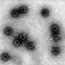 Hepatitis B Impfstoff
