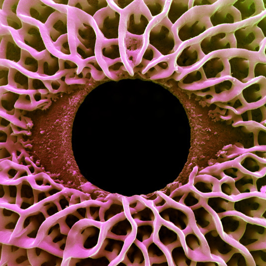 Pelargonium zonale (Geranie): Detail eines Pollenkorns mit Keimöffnung